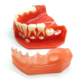 Стоматологическая Модель зубов Смешанный Зубной Ряд Модель Детского Развития 5-9 Лет M7012